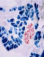 Pancreatic Acinar and Insulin-Producing Cells